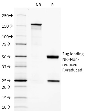 Data from SDS-PAGE analysis of Anti-Adiponectin antibody (Clone ADPN/1370). Reducing lane (R) shows heavy and light chain fragments. NR lane shows intact antibody with expected MW of approximately 150 kDa. The data are consistent with a high purity, intact mAb.